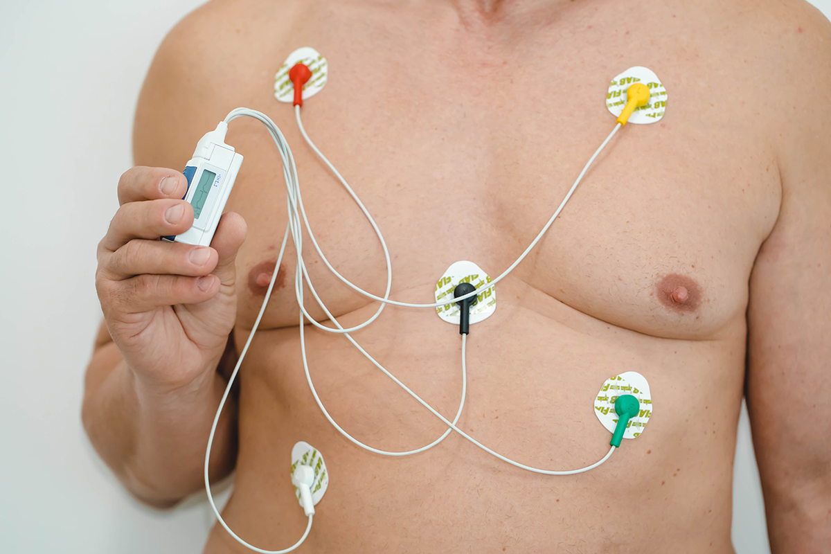ECG Holter