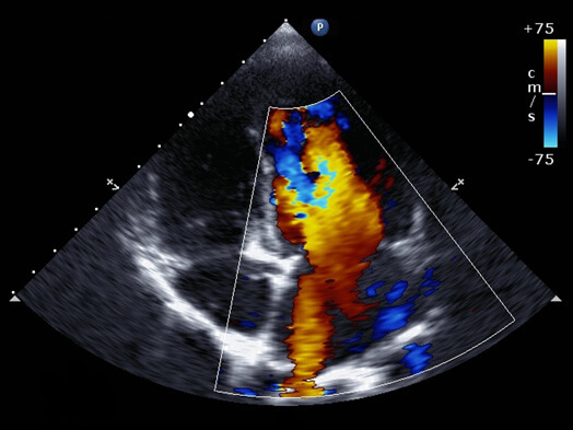 Ecocardiogramma colordoppler per valutazione cardiologica