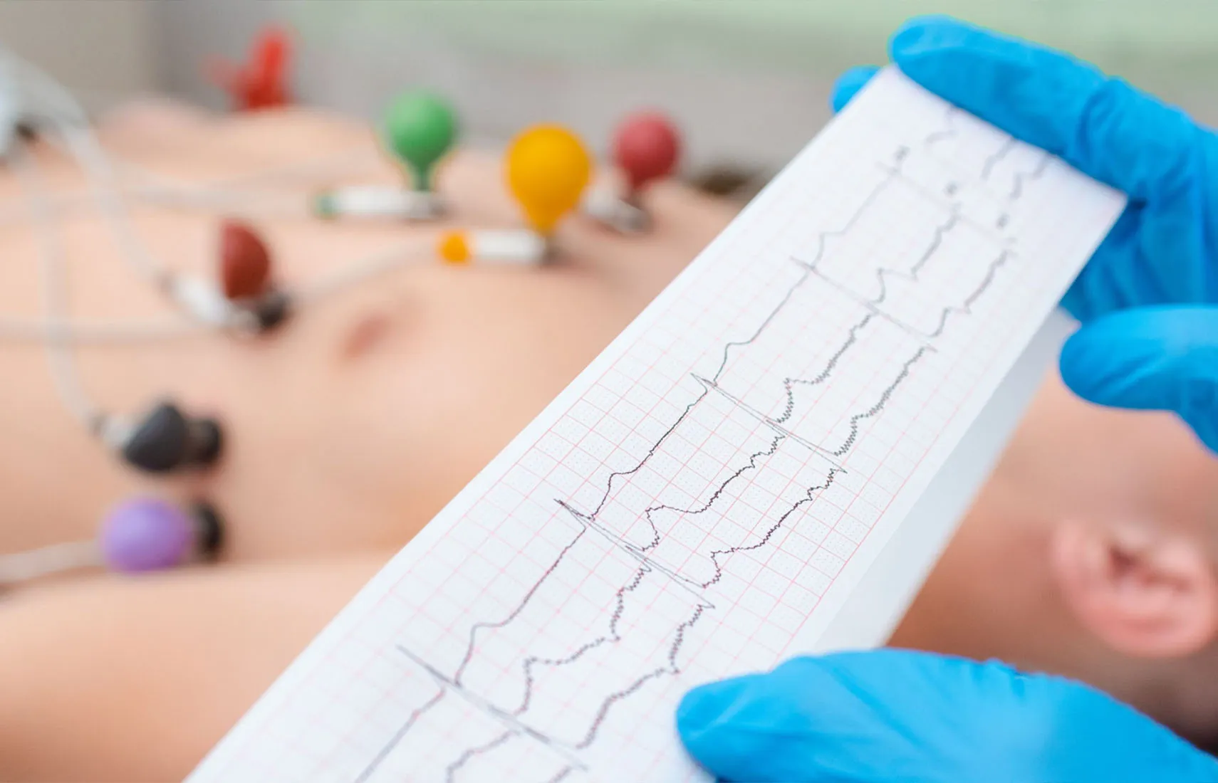 Visita Cardiologica con ECG